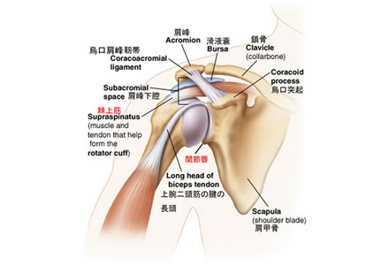 五十肩・肩関節周囲炎イメージ